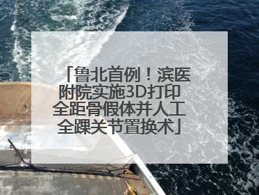 鲁北首例！滨医附院实施3D打印全距骨假体并人工全踝关节置换术